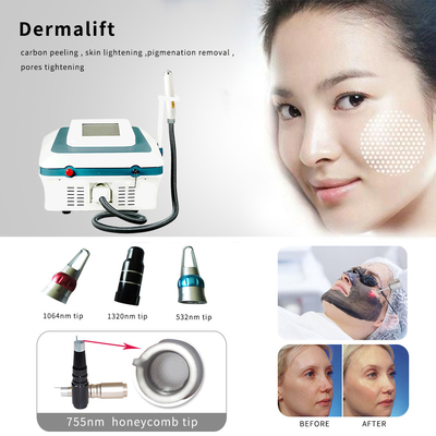 China 1320nm Laser Tattoo Removal Machine , Portable Tattoo Removal Machine supplier